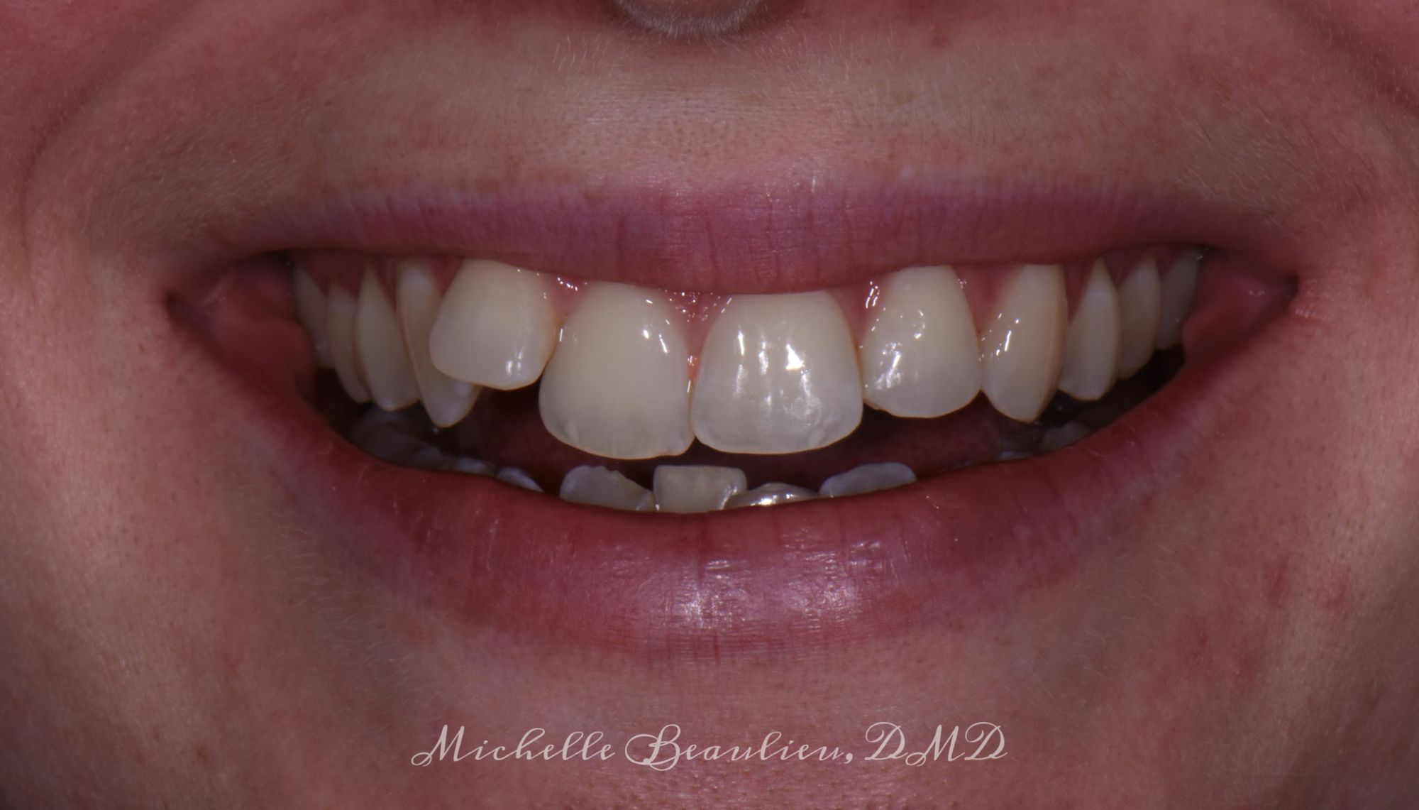 Dr Beaulieu's Work Brightwork Dental Care